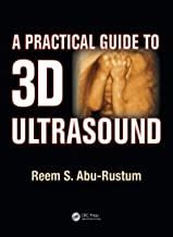 A PRACTICAL GUIDE TO 3D ULTRASOUND (PB) 