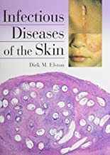INFECTIOUS DISEASES OF THE SKIN (HB) 