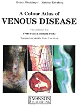 A COLOUR ATLAS OF VENOUS DISEASE WITH CONTRIBUTIONS FROM FRANZ PLATZ & REINHARD 