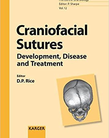 CRANIOFACIAL SUTURES DEVELOPMENT DISEASE AND TREATMENT VOL 12 (HB) 