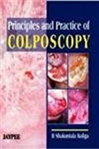 PRINCIPLES AND PRACTICE OF COLPOSCOPY 