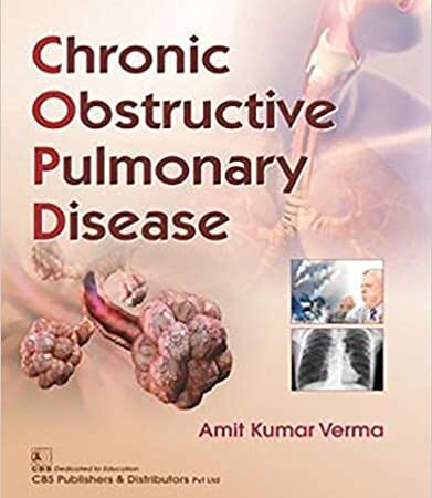 CHRONIC OBSTRUCTIVE PULMONARY DISEASE (PB) 